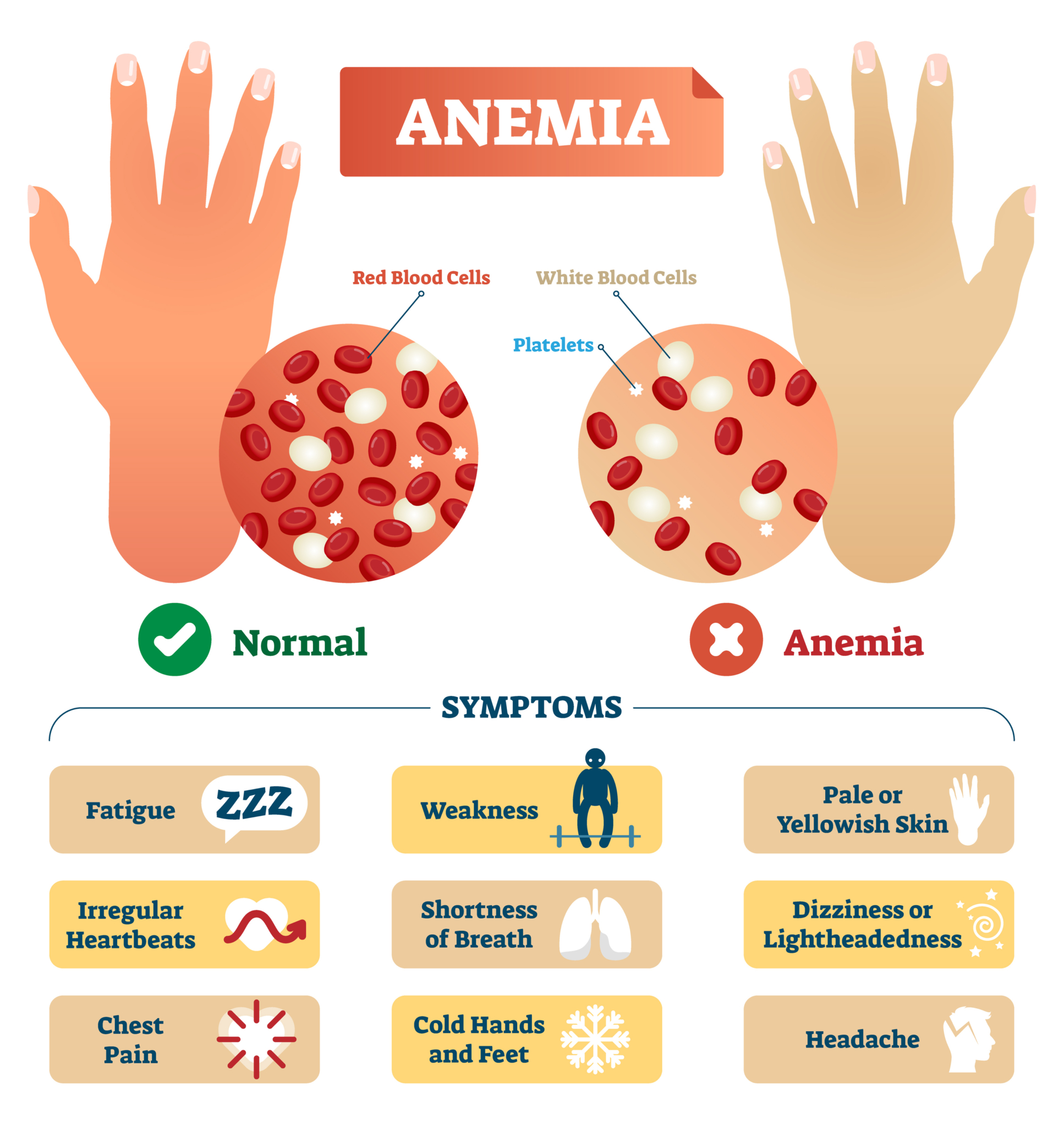 Anemia preventing weight loss