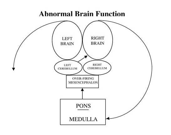 diagram of dysfunctional brain pathways in need of brain exercises